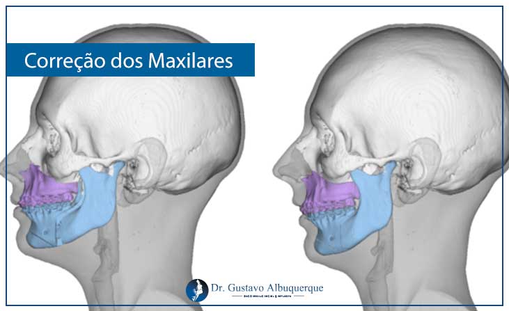 Relações maxila e mandíbula em dentados 